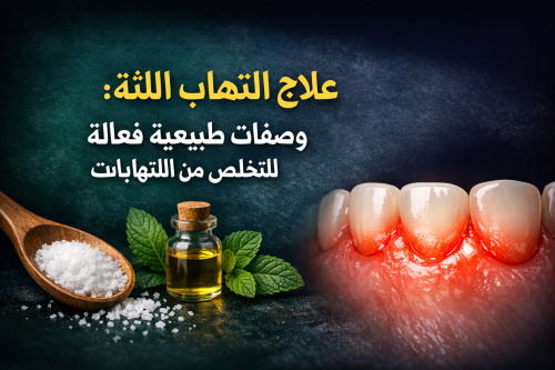 علاج التهاب اللثة: وصفات طبيعية فعالة للتخلص من الالتهابات