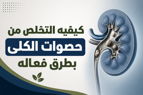 كيفيه التخلص من حصوات الكلى بطرق فعاله